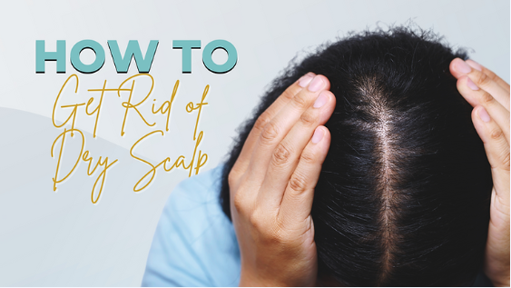 How to Get Rid of Dry Scalp in 4 Easy Steps