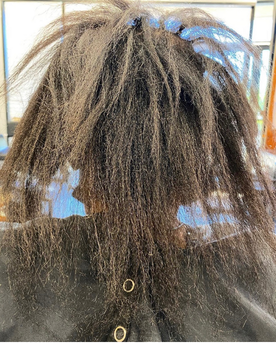 COVID-19 Hair Loss and Thinning. What Can You Do?