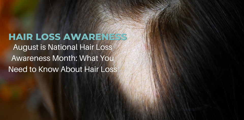 August is National Hair Loss Awareness Month: What You Need to Know About Hair Loss