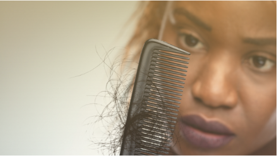 5 Reasons Why You're Losing Your Hair and How to Stop It